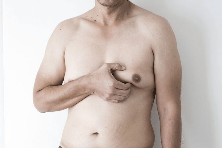 hoe kom je van manboobs af